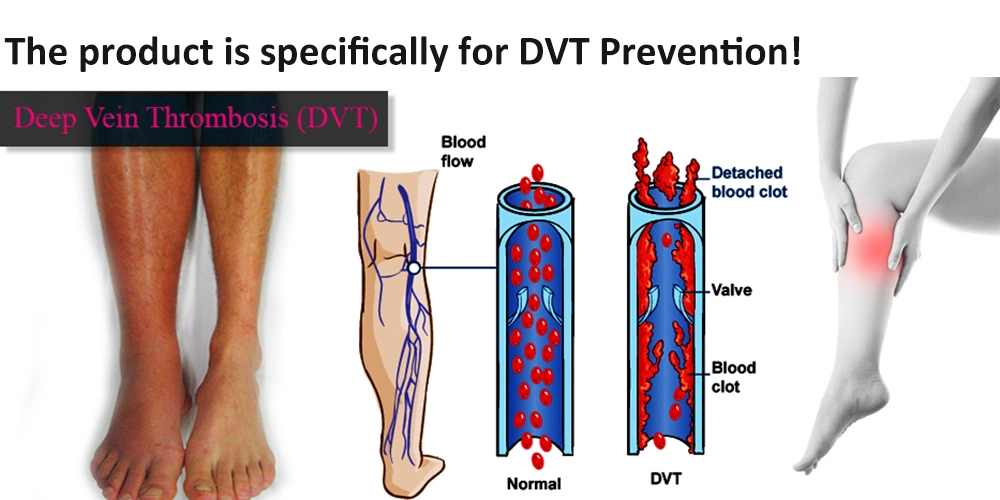 Portable Sequential Pneumatic Compression Device for Dvt